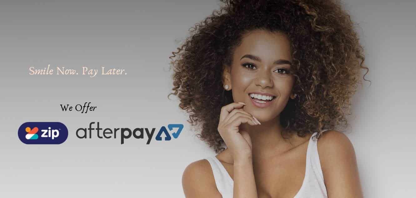 Smile Now, Pay Later