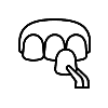 Composite Veneers